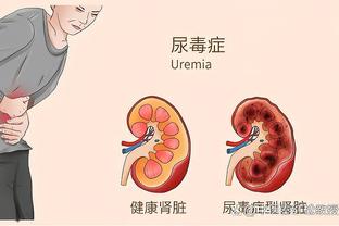 瓜迪奥拉：我们表现非常、非常、非常好 拿不到分我们无能为力